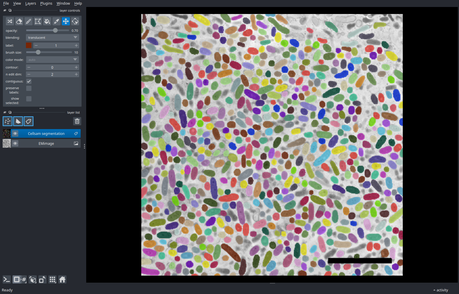 plot electron microscopy